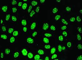 Image of Anti-nuclear antibodies (ANA) positive control speckled pattern