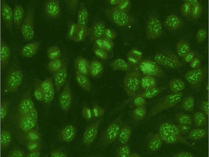 Image of Anti-nuclear antibodies (ANA) positive control centromere pattern